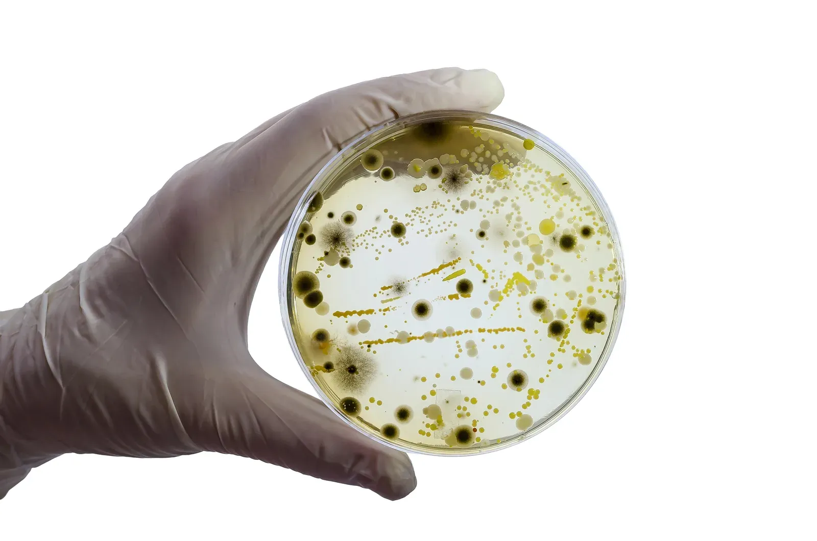 SIBO (Small Intestinal Bacterial Overgrowth)