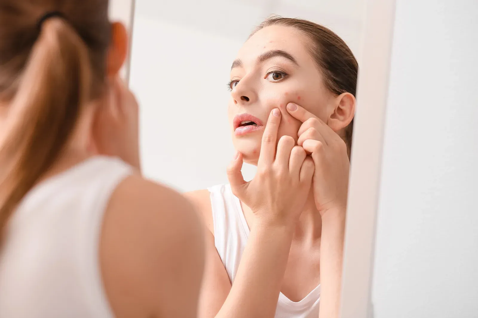 Skin Congestion