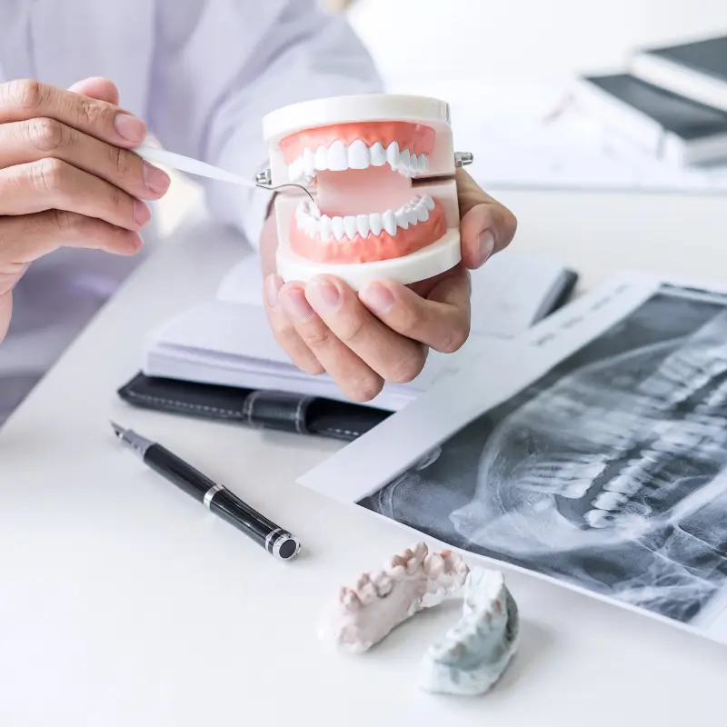 Chiropractor Melbourne explaining TMJ dysfunction using dental model and jaw X-ray